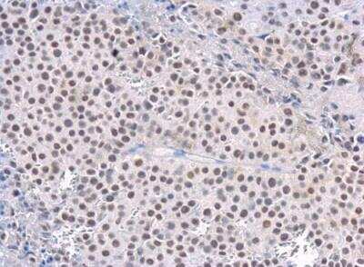 Immunohistochemistry-Paraffin: Rad50 Antibody (13B3) [NB100-147]