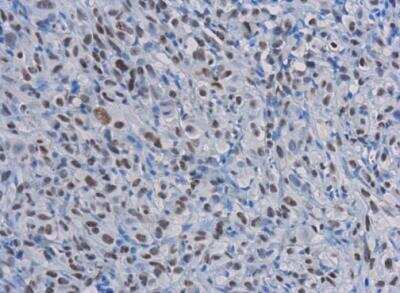 Immunohistochemistry-Paraffin: Rad50 Antibody (13B3) [NB100-147]