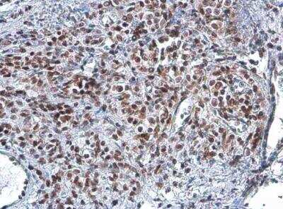 Immunohistochemistry-Paraffin: Rad50 Antibody (13B3) [NB100-147]