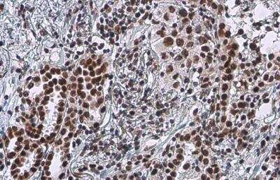 Immunohistochemistry-Paraffin: Rad50 Antibody (13B3) [NB100-147]