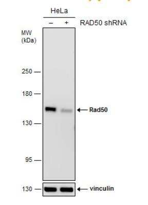 Knockdown Validated: Rad50 Antibody (13B3) [NB100-147]
