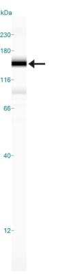 Simple Western: Rad50 Antibody [NB100-1487]