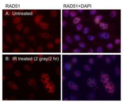Immunocytochemistry/ Immunofluorescence: Rad51 Antibody (14B4) [NB100-148]