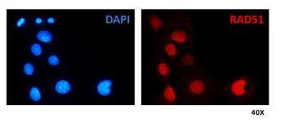 Immunocytochemistry/ Immunofluorescence: Rad51 Antibody (14B4) [NB100-148]