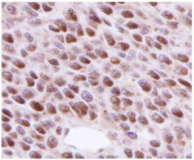 Immunohistochemistry-Paraffin: Rad51 Antibody (14B4) [NB100-148]