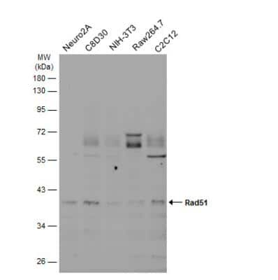 Western Blot: Rad51 Antibody (14B4) [NB100-148]