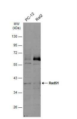 Western Blot: Rad51 Antibody (14B4) [NB100-148]