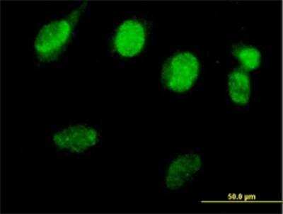 Immunocytochemistry/ Immunofluorescence: Rad51 Antibody [H00005888-B01P]