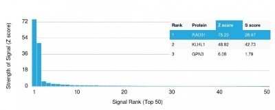 Protein Array: Rad51 Antibody (RAD51/2701) - Azide and BSA Free [NBP2-79895]