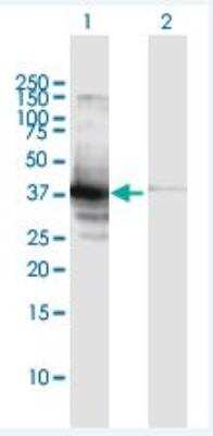 Western Blot: Rad51 Antibody [H00005888-B01P]