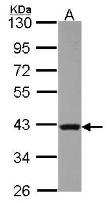 Western Blot: Rad51 Antibody [NBP2-20058]