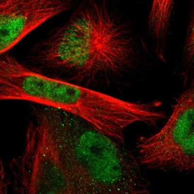 Immunocytochemistry/ Immunofluorescence: Rad9 Antibody [NBP1-87163]