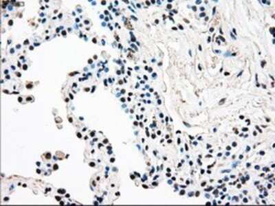 Immunohistochemistry: Rad9 Antibody (OTI7B11) - Azide and BSA Free [NBP2-73783]