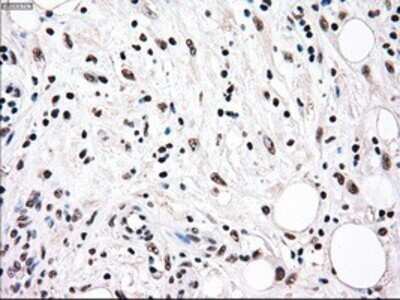 Immunohistochemistry: Rad9 Antibody (OTI7B11) - Azide and BSA Free [NBP2-73783]