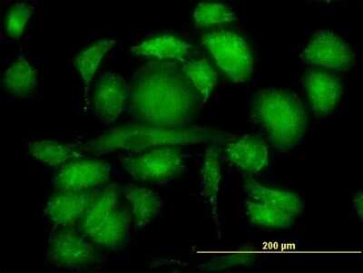 Immunocytochemistry/ Immunofluorescence: Radixin Antibody (1D9) [H00005962-M06]