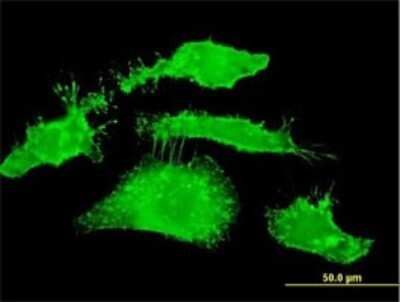 Immunocytochemistry/ Immunofluorescence: Radixin Antibody (1E12) [H00005962-M01]