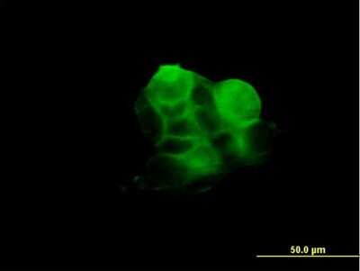 Immunocytochemistry/ Immunofluorescence: Radixin Antibody (1F6) [H00005962-M03]