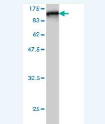 Western Blot: Radixin Antibody (2E7) [H00005962-M04]