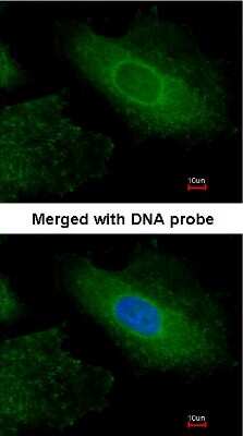 Immunocytochemistry/ Immunofluorescence: Radixin Antibody [NBP1-31553]