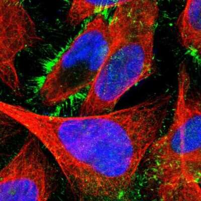 Immunocytochemistry/ Immunofluorescence: Radixin Antibody [NBP1-85238]