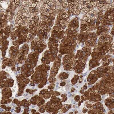 Immunohistochemistry-Paraffin: Radixin Antibody [NBP1-85238]
