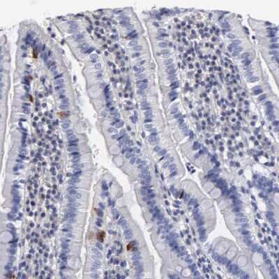 Immunohistochemistry-Paraffin: Radixin Antibody [NBP1-85238]