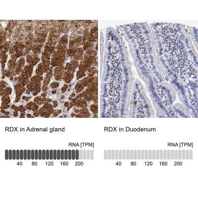 Immunohistochemistry-Paraffin: Radixin Antibody [NBP1-85238]