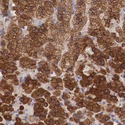 Immunohistochemistry-Paraffin: Radixin Antibody [NBP1-85239]