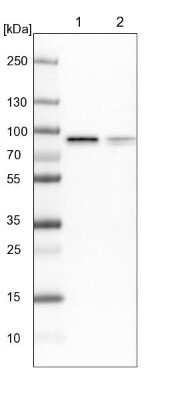 Western Blot: Radixin Antibody [NBP1-85239]