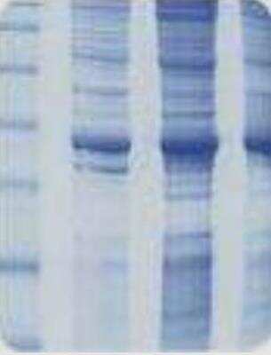 SDS-PAGE: Raji Whole Cell Lysate [NB820-59466]