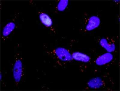 Proximity Ligation Assay: RalA/RalB Antibody (3E6) [H00005898-M01]