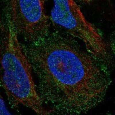 Immunocytochemistry/ Immunofluorescence: RalA/RalB Antibody [NBP3-17302]