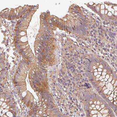 Immunohistochemistry: RalA Antibody [NBP2-46872]