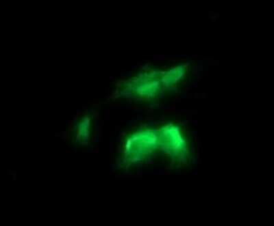 Immunocytochemistry/ Immunofluorescence: RalB Antibody (OTI2C4) - Azide and BSA Free [NBP2-73785]