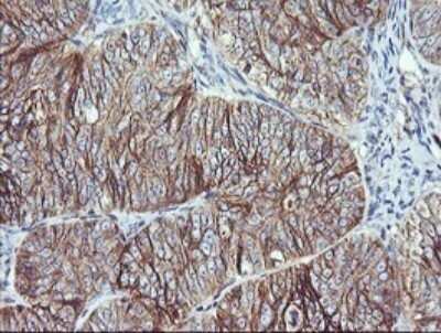 Immunohistochemistry: RalB Antibody (OTI2C4) - Azide and BSA Free [NBP2-73785]