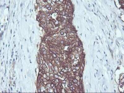 Immunohistochemistry: RalB Antibody (OTI2C4) - Azide and BSA Free [NBP2-73785]