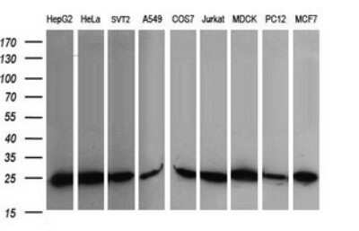 Western Blot: RalB Antibody (OTI2C4) [NBP2-45927]