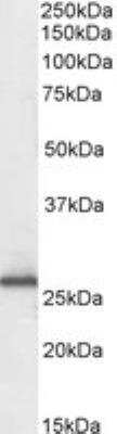 Western Blot: RanBP1 Antibody [NB100-1443]
