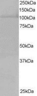 Western Blot: RanBP16 Antibody [NB100-1378]
