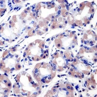 Immunohistochemistry-Paraffin: RanBP2 Antibody (2E1) [NB100-74480]