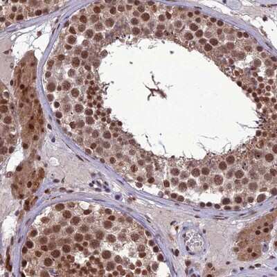 Immunohistochemistry-Paraffin: RanBP3 Antibody [NBP1-92314]