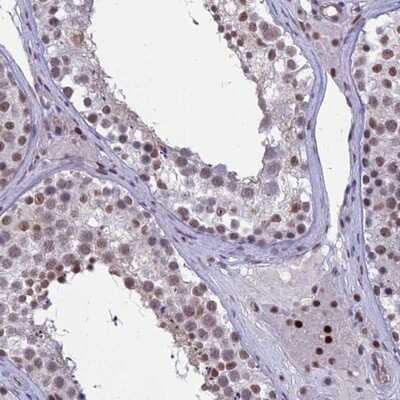 Immunohistochemistry-Paraffin: RanBP3 Antibody [NBP1-92315]
