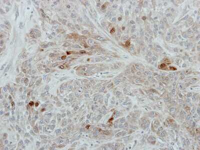 Immunohistochemistry-Paraffin: RanBP3 Antibody [NBP2-20066]