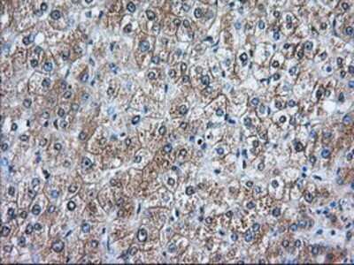 Immunohistochemistry-Paraffin: RanGAP1 Antibody (OTI1B4) [NBP2-02623]