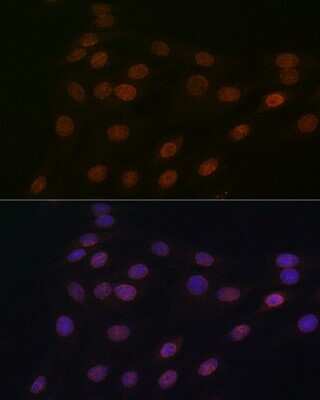 Immunocytochemistry/ Immunofluorescence: RanGAP1 Antibody (1E7R7) [NBP3-16697]