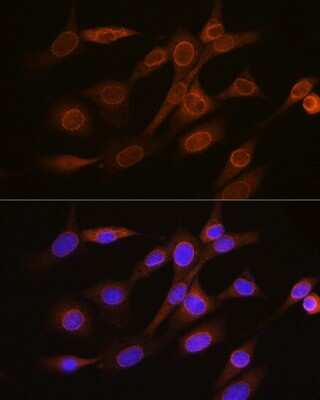 Immunocytochemistry/ Immunofluorescence: RanGAP1 Antibody (1E7R7) [NBP3-16697]