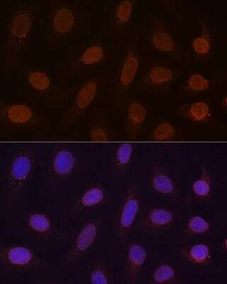 Immunocytochemistry/ Immunofluorescence: RanGAP1 Antibody (1E7R7) [NBP3-16697]