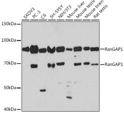Western Blot: RanGAP1 Antibody (1E7R7) [NBP3-16697]