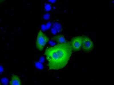 Immunocytochemistry/ Immunofluorescence: RanGAP1 Antibody (OTI1B4) - Azide and BSA Free [NBP2-73797]