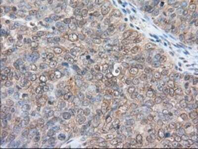Immunohistochemistry: RanGAP1 Antibody (OTI1B4) - Azide and BSA Free [NBP2-73797]
